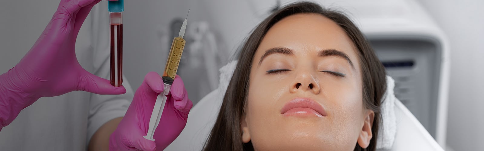 prp for hair loss